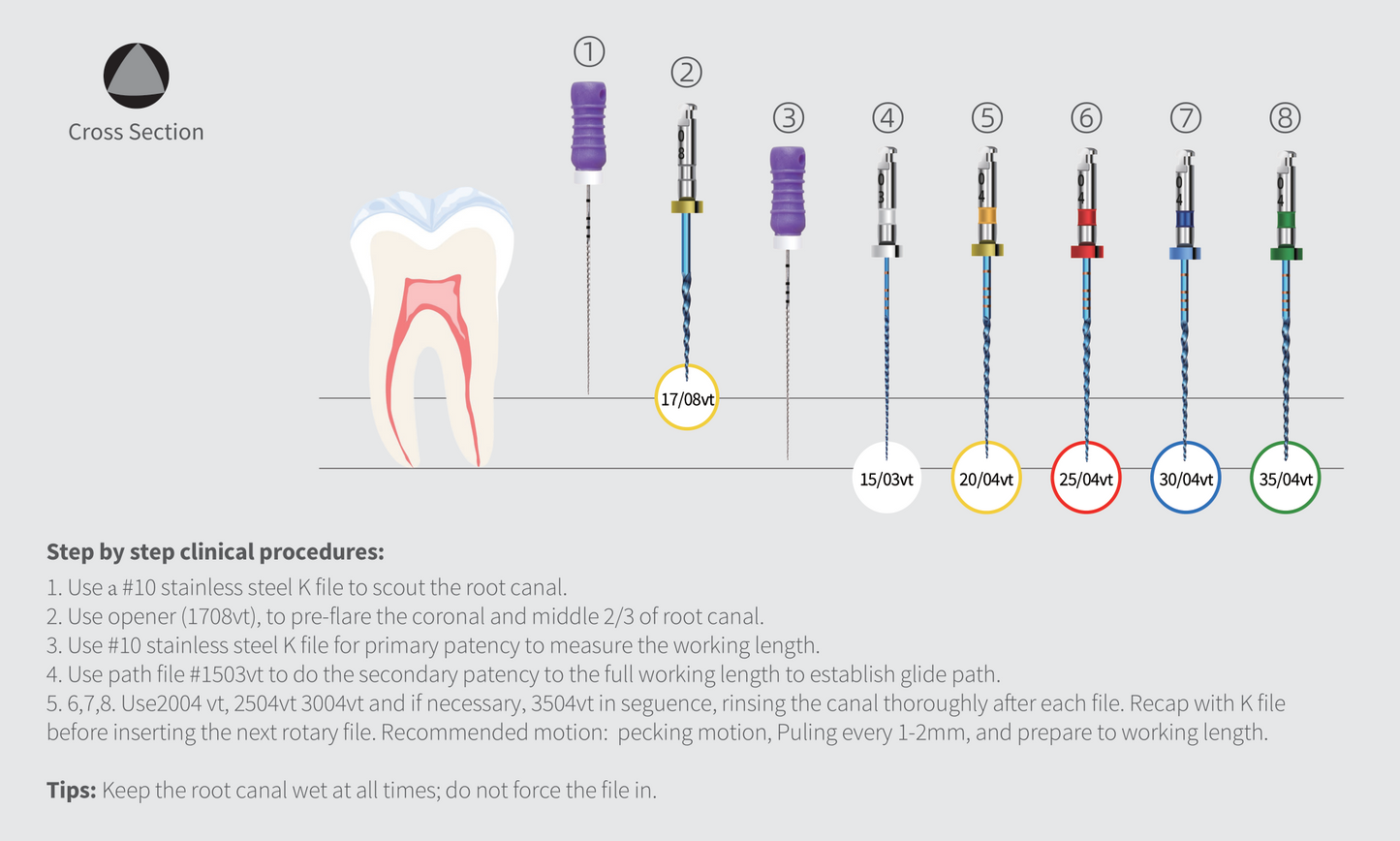 Endo Rotary Files - SuPliable